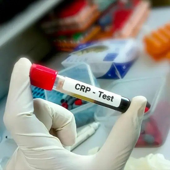 HIGH SENSITIVITY C-REACTIVE PROTEIN (HS-CRP)